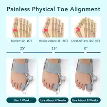 Hallux Valgus Bunion Corrector