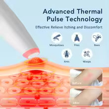 Electronic Mosquito Bite Pen