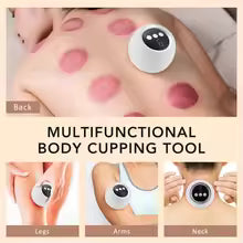 Smart Cupping Massager Device