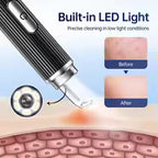 Smart Blackhead & Pimple Remover Kit