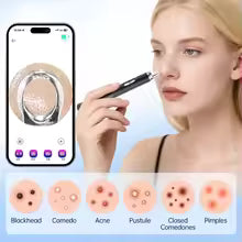 Smart Blackhead & Pimple Remover Kit
