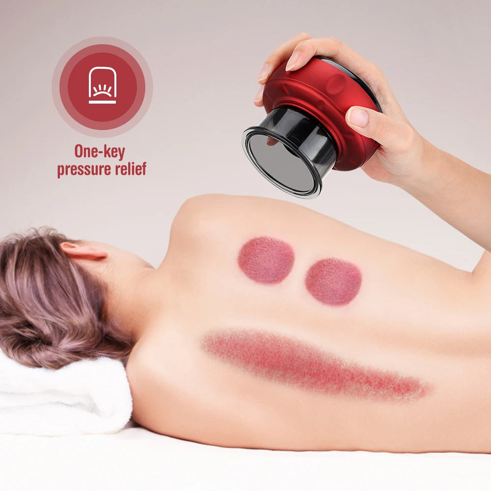 Smart Electric Cupping Therapy Set – Heated Vacuum Massage Jars for Cellulite & Body Relaxation