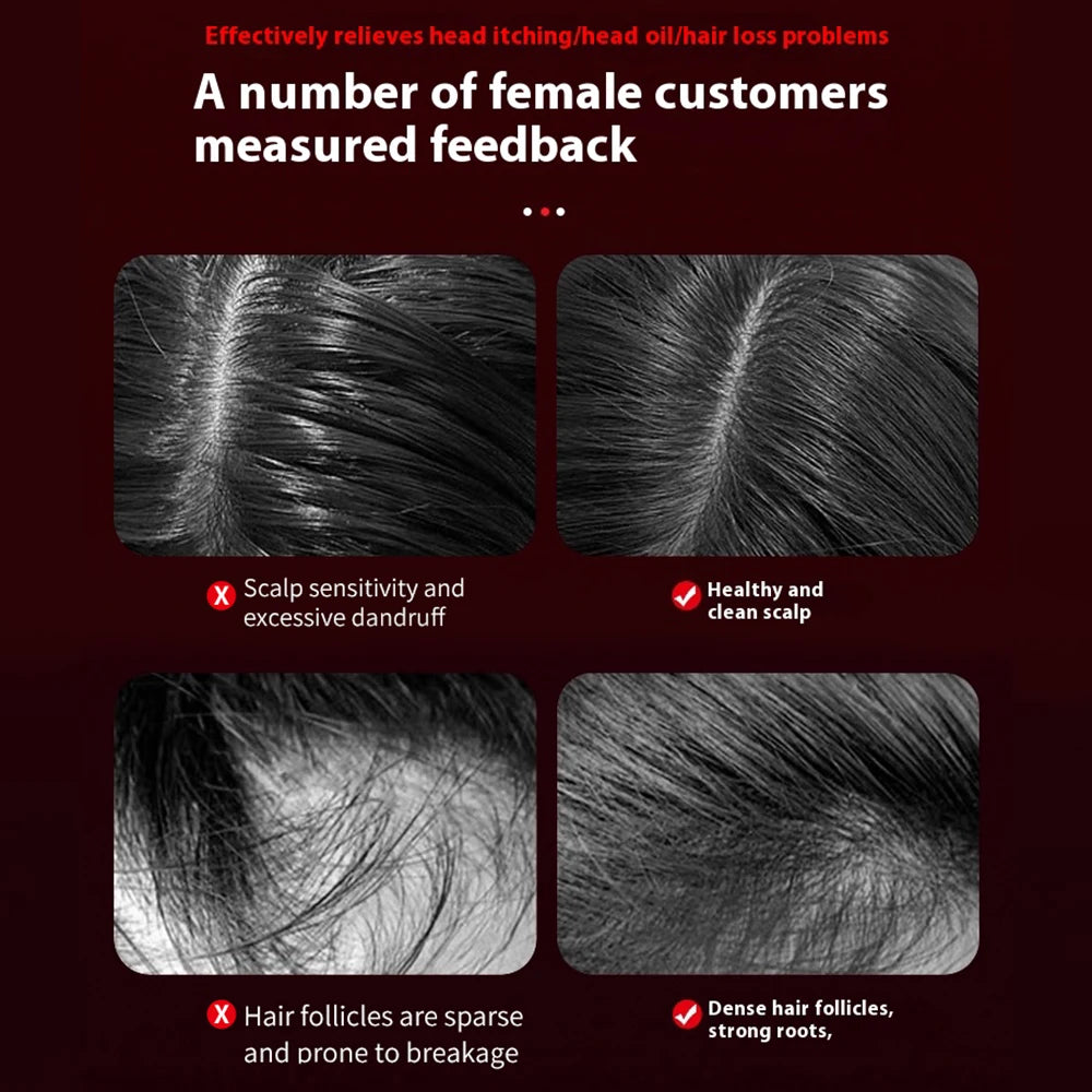 Hair Scalp Massage Tool