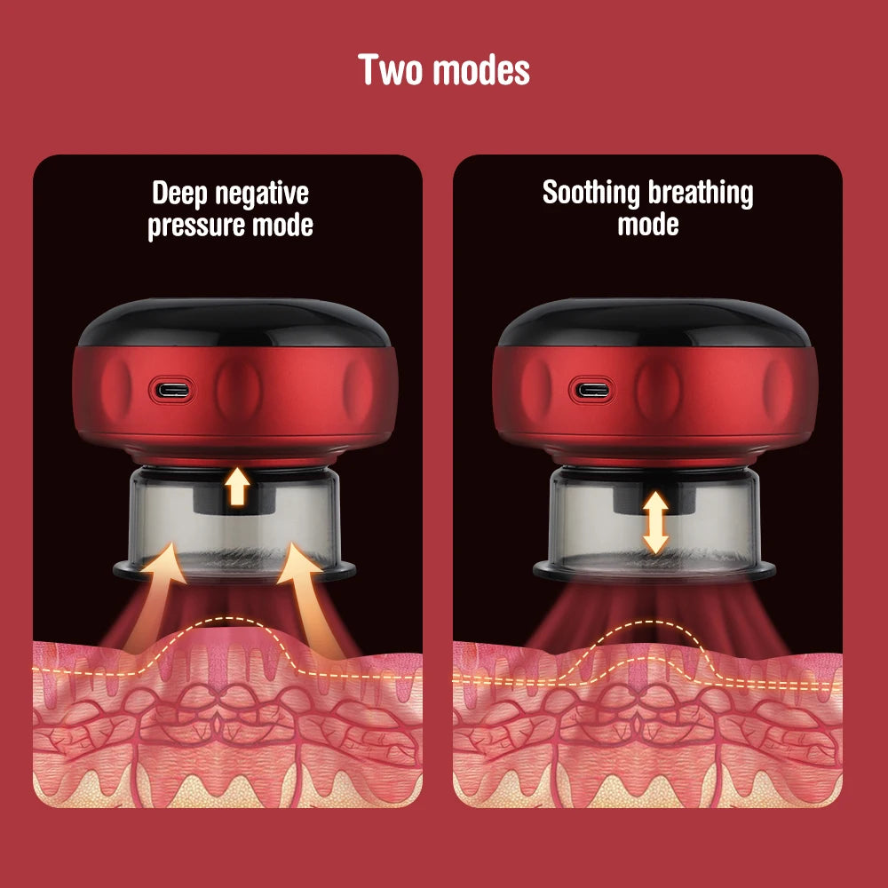 Smart Electric Cupping Therapy Set – Heated Vacuum Massage Jars for Cellulite & Body Relaxation